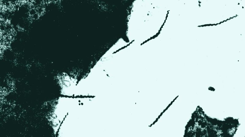 STDs are rampant in Mississippi. This one is now considered an epidemic.