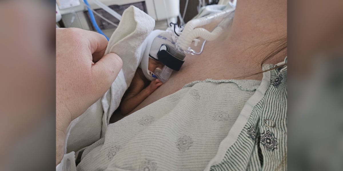 Superhero Mom: Biloxi mother recounts traumatic birth story and her baby’s resiliency