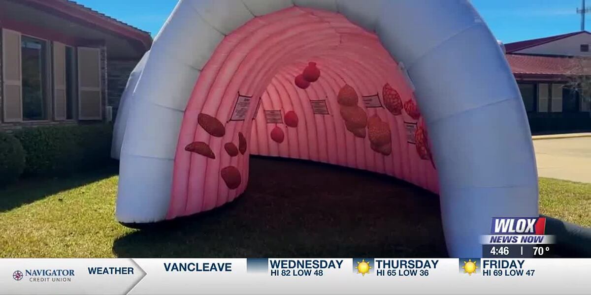 Small Inflatable Colon Giant inflatable colon in Ocean Springs helps promote colorectal cancer ...